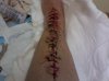 Doug's Leg Stitched.jpg